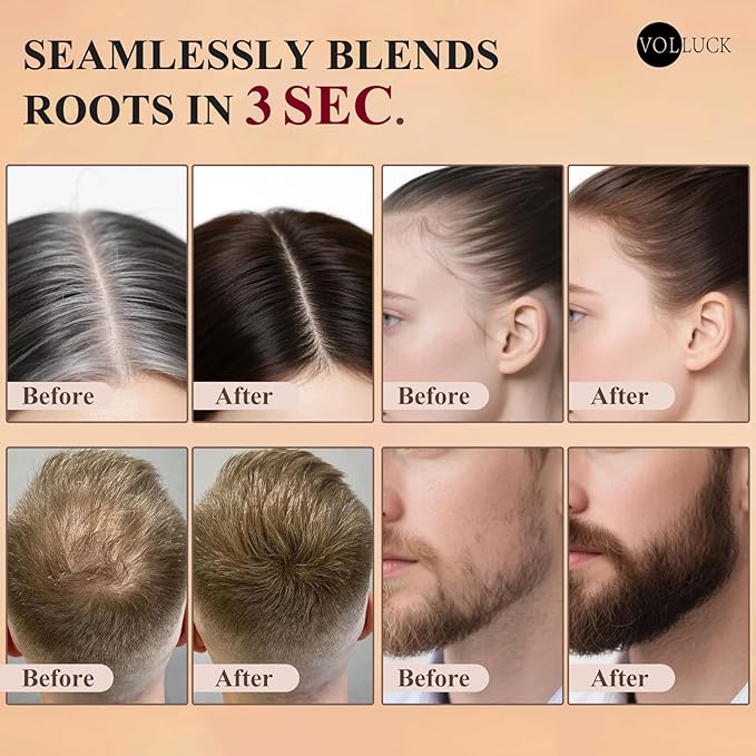 VOLLUCK Hairline Powder Instantly, Root Touch up Powder Hair Color Upgraded, Grey Root Cover up Conceals Hair Loss, Hairline Shadow for Women & Men for Thinning Hair Natural, Sweatproof (Medium Brown)