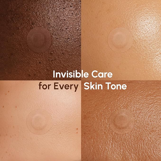 MAREE Invisible Pimple Patches - Clear Pimple Patches for Face - Hydrocolloid Acne Patches Anti Blemish - Zit Stickers for Face - Parches Para Acne - Pinple Zit Patches Pimple Stickers - 72 Dots