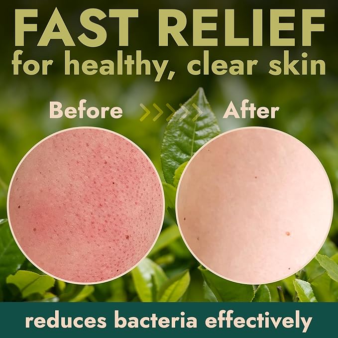 Exfoliating Body Scrub with Antibacterial Formula | Body Scrub Kills 99.9% of Germs & Bacteria | Manuka Honey & Charcoal | Deep Cleansing & Purifying for Smooth, Fresh, Healthy Skin | 16 fl oz Jar