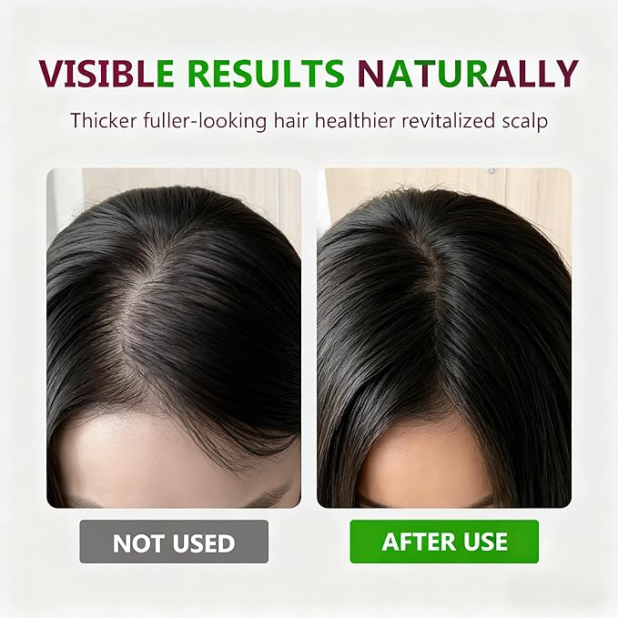 Hair Growth Serum for Men & Women - Advanced Hair Regrowth Treatment with Ginseng, Biotin & Keratin - Strengthens Roots, Reduces Breakage, Promotes Thicker & Fuller Looking Hair