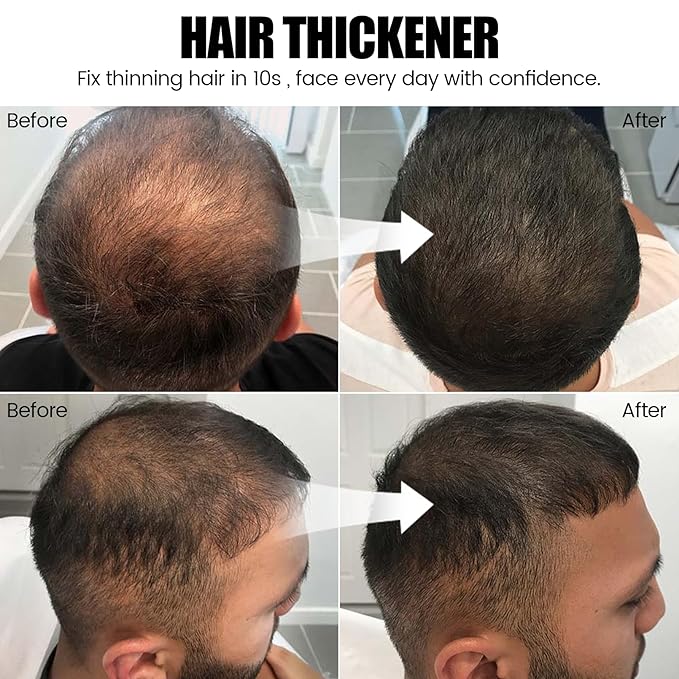 VOLLUCK Hair Thickening Fibers Spray, Temporary Colored Hair Thickener for Root Touch Up Spray, Grey Coverage Root Concealer for Women & Men, | Volumizing & Thickening | Medium Brown