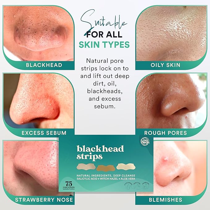 LivaClean (75 CT) Pore Strips w/Salicylic Acid, Witch Hazel & Aloe Vera - Blackhead Remover for Face Nose Pores Blackheads Removal - Blackhead Remover Strip
