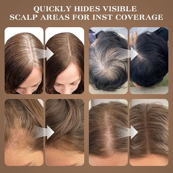 Hairline Shadow Powder, Red Brown, Root Touch Up Powder for Instantly Gray Hair Cover Up, Women Color Root Coverage for Thinning Grey, Mens Roots Concealer for Hair Loss Beard Line, #7