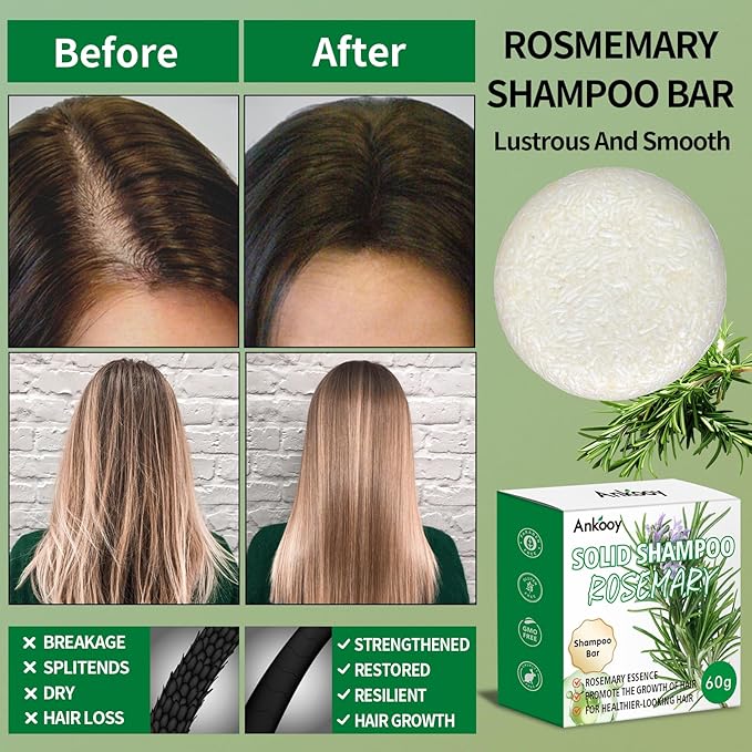 2 Pack Solid Shampoo Bar with Rosemary Oil for Thinning Hair,Natural&Organic Hair Shampoo Soap Bar for Women&Men,Strengthens,Thickens,Controls Oil,Dandruff Solid Soap for Scalp Cleansing&Volume