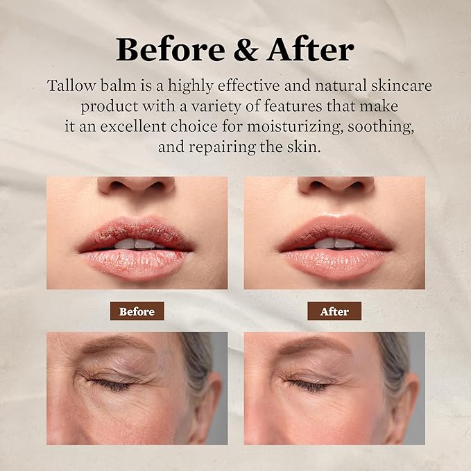 Tallow Face Moisturizer for Women: Beef Tallow Balm with Raw Honey and Olive Oil for Mature Skin – 100% Whipped and Grass Fed Cow Fat Facial Cream
