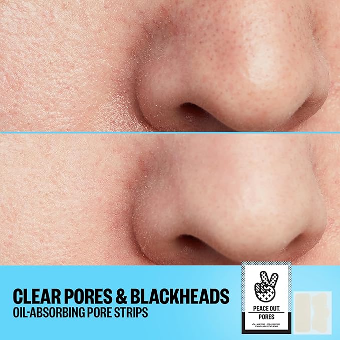PEACE OUT Skincare Pore Minimizing Strips, Hydrocolloid Pore-Refining Nose and Face Strips with Retinol & Vitamin A to Shrink Enlarged Pores and Remove Blackheads (4 pore and 4 nose strips)
