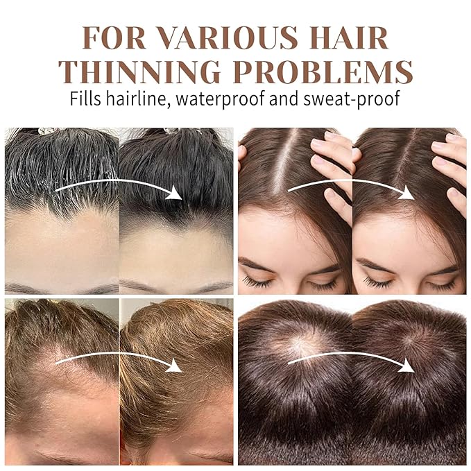 Hairline Powder Instantly, Fill In Fine or Root Touch up powder,Thinning Hair Instantly Thicker Touch Up for Windproof&Sweatproof, Darkroot touch up for Men & Women (ASH BROWN丨4g/0.14Ounce)