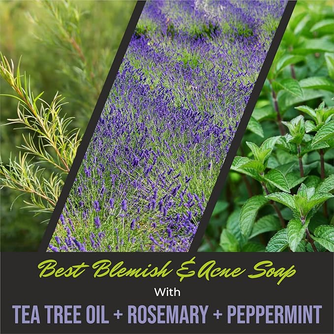 First Botany, ALL Natural Body Wash - Fights Body Odor, Athlete's Foot, Jock Itch, Nail Issues, Dandruff, Acne, Eczema, Shower Gel for Women & Men, Skin Cleanser -16 fl oz (Rosemary Mint)