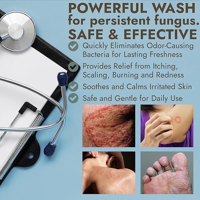 Antibacterial Body Wash | Antifungal Soap for Men & Women | Kills 99.9% of Germs & Bacteria | Helps with Back Acne, Body Odor, Jock Itch & Skin Irritation | Manuka Honey & Charcoal, 16 fl oz