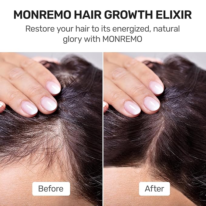 Hair Growth Serum with Turmeric, Caffeine & Biotin – Fast-Absorbing Regrowth & Scalp Treatment Serum for Fuller Hair – Lightweight Vegan Formula – Ideal for Thinning, Weak Hair & Daily Use