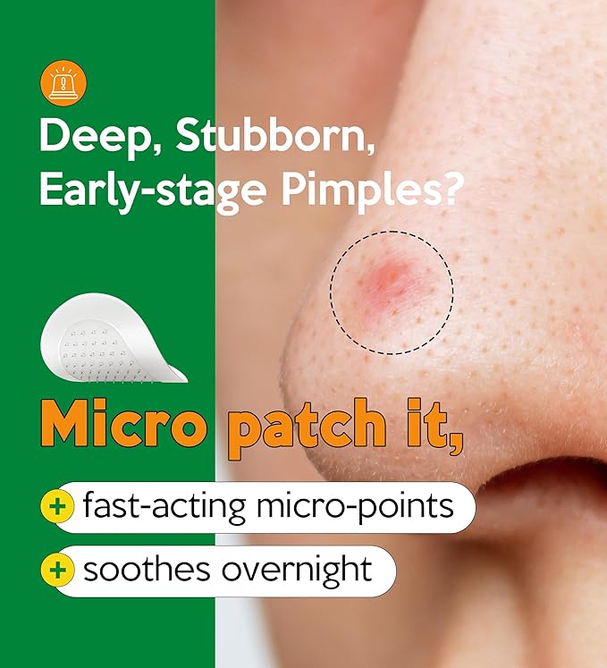 Troubless Micro-Point Patch Plus Limited Value Pack - Thin Hydrocolloid for Targeted Application w/ 180 Micro-Points - High-Absorption, Seamless Adhesion & Easy-Wear Zit Patches for Face (18 ea)