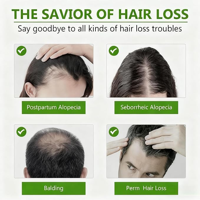 Hair Growth Serum for Men & Women - Advanced Hair Regrowth Treatment with Ginseng, Biotin & Keratin - Strengthens Roots, Reduces Breakage, Promotes Thicker & Fuller Looking Hair