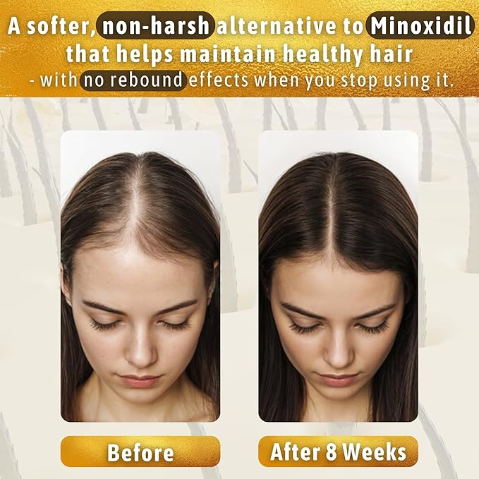 Hair Growth Serum Women & Men — 10-in-1 Tricho10™ Scalp Serum for Thicker, Fuller Hair & a Healthier Scalp — Fast-Absorbing, 3X Strengthening Blend for Thinning Hair & All Hair Types (1 fl oz / 30 ml)