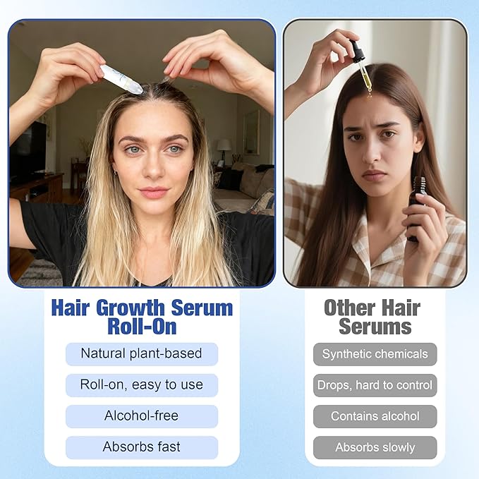 Hair Growth Serum Roll-On (25ml) Powered by 3% Rosemary, 3% Redensyl & 2% Anagain, DHT Blocker for Stronger, Thicker Hair, Paraben, Sulfate-Free, Suitable for Men & Women
