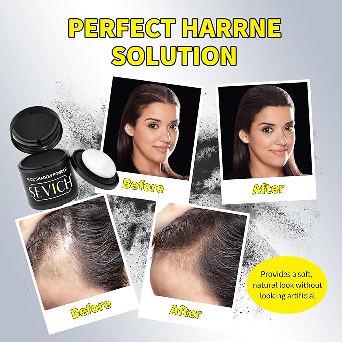 Sevich Hairline Powder 10g 2-Pack with Brush, Instantly Conceals Hair Loss & Thinning, 48H Waterproof Root Touch Up Powder, Natural Hair Shadow Toppers for Women & Men, 2 Box = 5 Boxes,Dark Brown