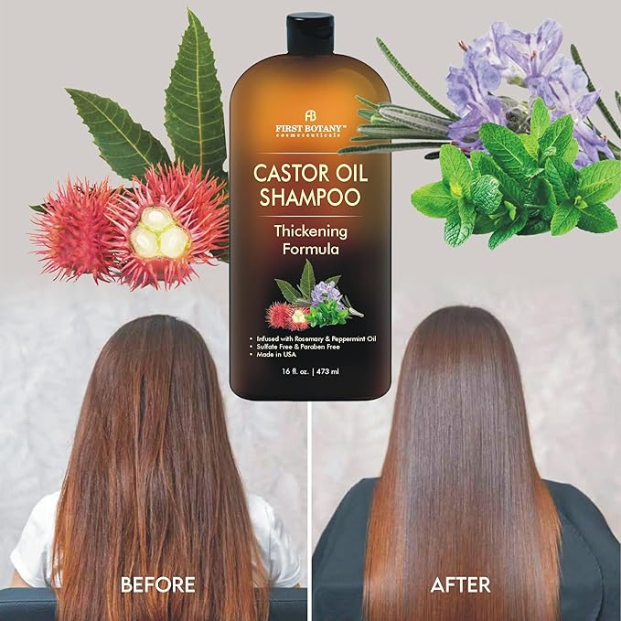 Castor Oil Shampoo - An Anti Hair Loss Shampoo Thickening formula For Hair Regrowth, Anti Thinning Sulfate Free For Men & Women Anti Dandruff Treatment 16 fl oz