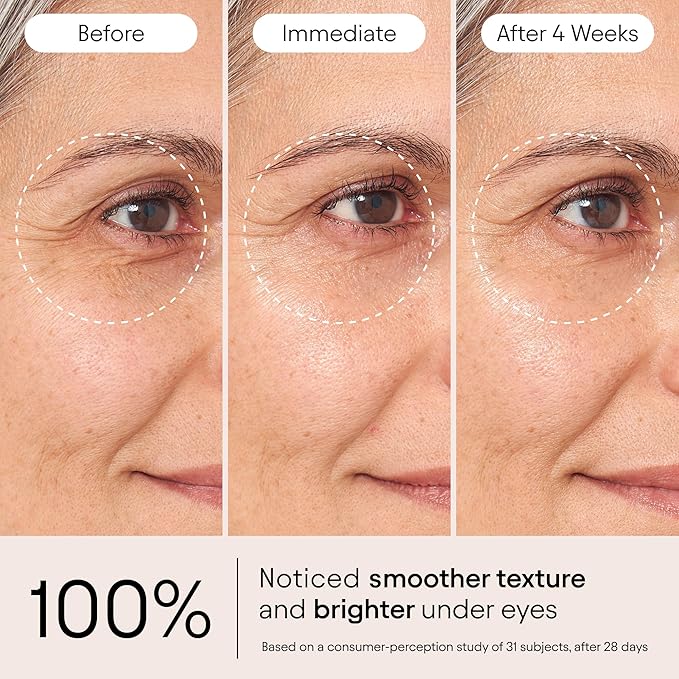ALPYN Instant Bright Eye with Peptides & Niacinamide | Brightens Dark Circles, Visibly Firms & Softens Fine Lines | 0.5 Fl Oz / 15 ml