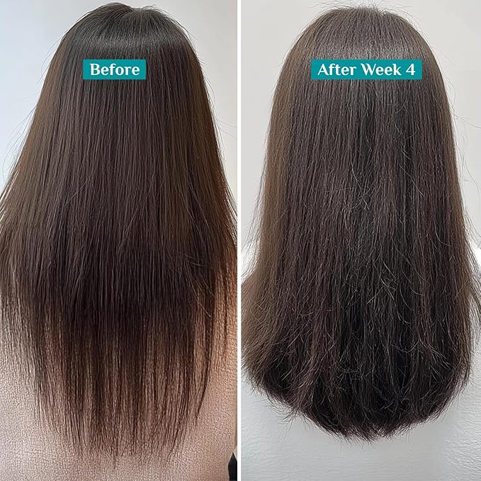 Pilgrim Redensyl & Anagain Hairfall Control Shampoo with Korean Black Rice 6.76 Fl Oz (200ml) | Anti Hairfall shampoo for Men & Women | Reduces Hairfall | Enhance Hair Thickness | For All Hair Types