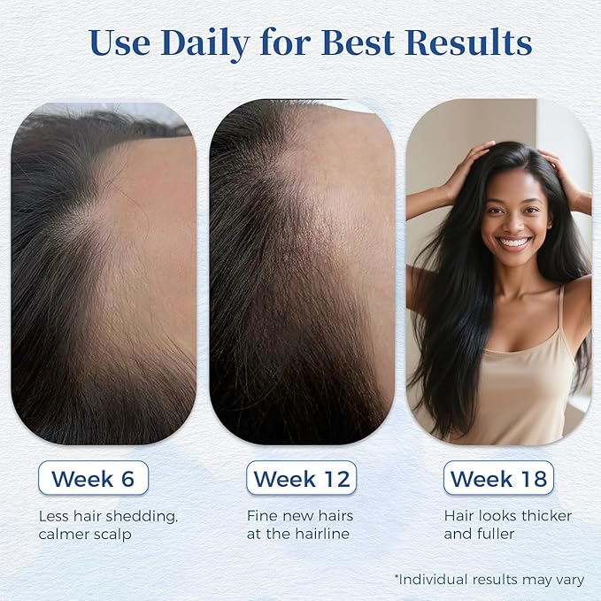 Hair Growth Serum Roll On 25ml/0.84Oz with Saw Palmetto, Rosemary & Pea Extract，Helps Support Thicker, Fuller Hair Appearance, Non-Greasy Hair Loss Support for Men & Women (2pcs)