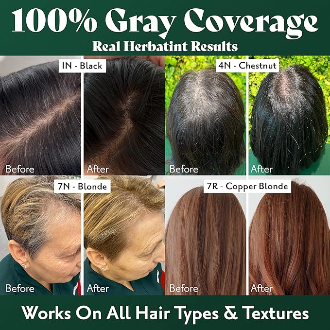 Herbatint Permanent Hair Dye For Women - 7N Blonde - For Up To 100% Gray Coverage of Resistant Gray Hair - Ammonia-Free, Alcohol-Free & Vegan - Salon Influenced Hair Color 5.75 fl oz