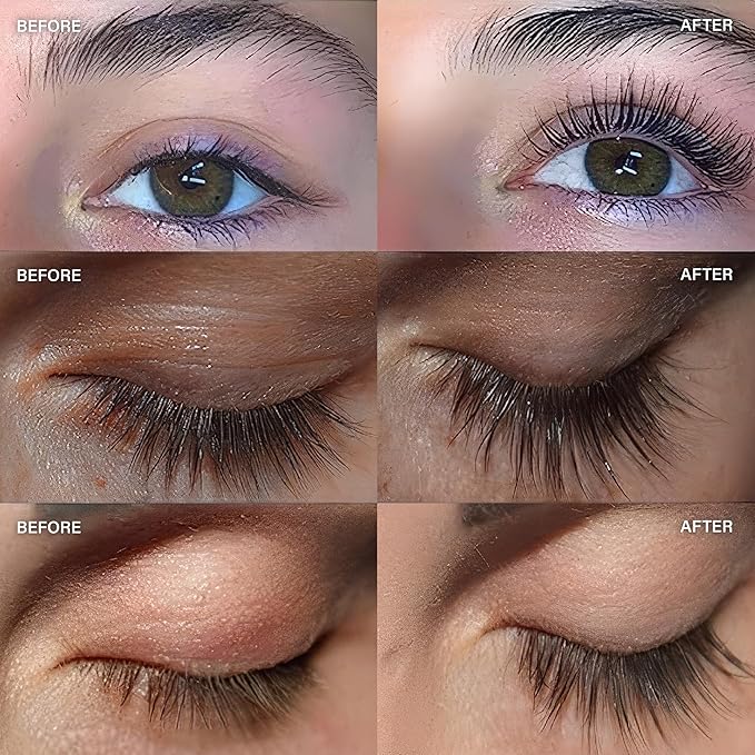 ForLash by ForChics: 3 Pack Ultimate Hormone- Free Eyelash Growth Serum for Enhanced Fuller, Thicker, Longer Lashes - Regrowth Booster, Organic Formula, Vegan & Cruelty-Free