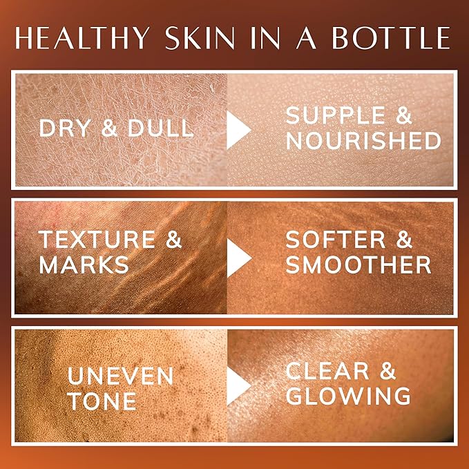 Bio+ Skin Moisturizer Body Oil for Women - Coconut, Jojoba, Olive & Almond Oils for Scars & Stretch Marks, Vanilla Scent & Vitamin E, Bio Oil Skincare, Stretch Mark Treatment