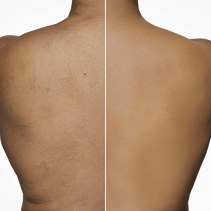 Dermablend Leg and Body Makeup Foundation with SPF 25, 85N Deep Natural, 3.4 Fl. Oz.