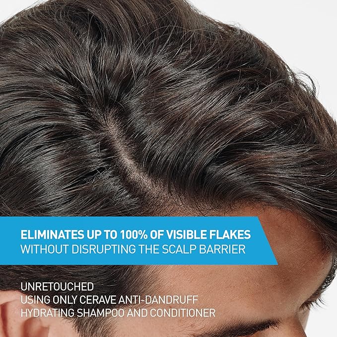 CeraVe Hydrating Anti Dandruff Shampoo, 1% Pyrithione Zinc Dandruff Treatment With Ceramides, Niacinamide & Hyaluronic Acid, Helps Eliminate Flakes & Provides Itchy Scalp Relief, Sulfate Free, 12 Oz