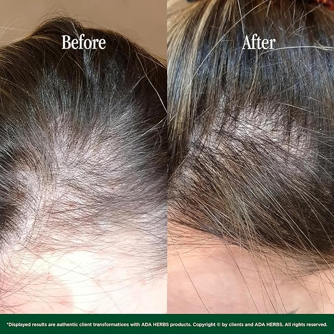 Hair Oil Mask Pre-Wash & Overnight 100% Natural Hair Growth Oil with Cold Pressed Argan, Castor, Jojoba, Rosemary, Vitamin E, Deep Conditioning for Dry Damaged Hair, Squalane from Olive (8.45 Fl Oz)